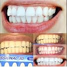 Cool Teeth Whitening Reviews