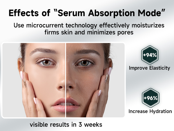 laser hair removal device