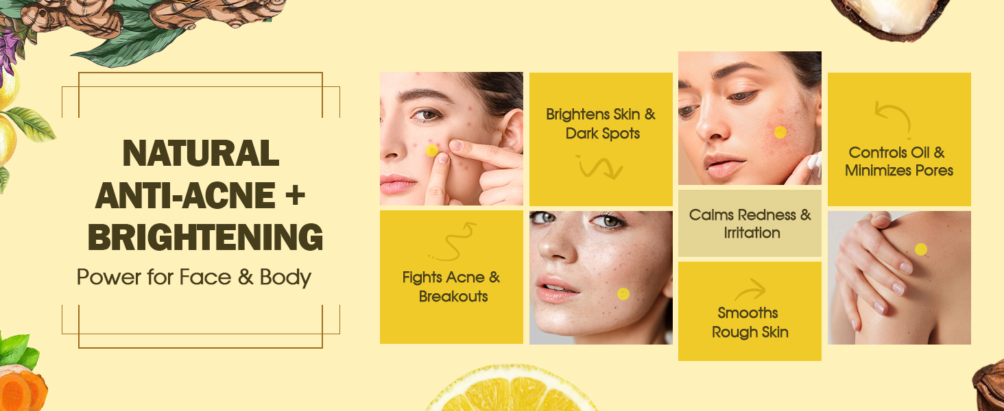 Natural Anti-Acne