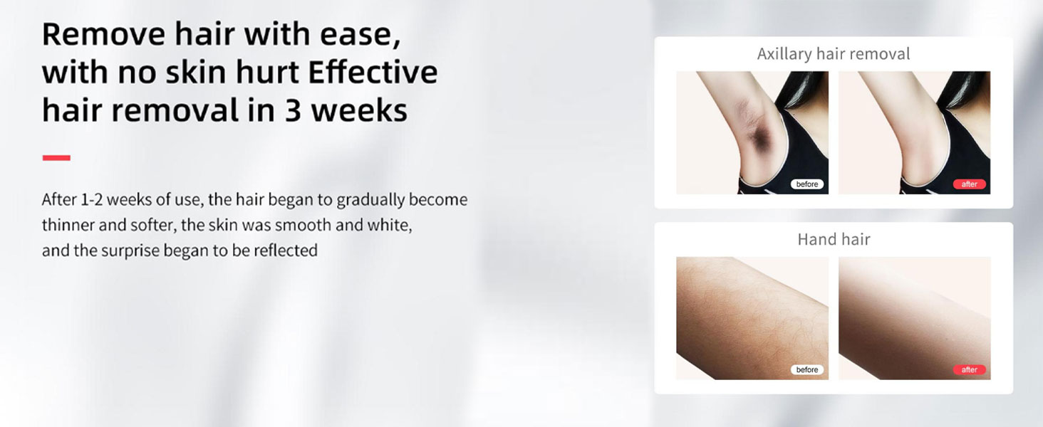 Laser Hair Removal,999,900+ Flashes IPL Hair Removal Device for Women and Men