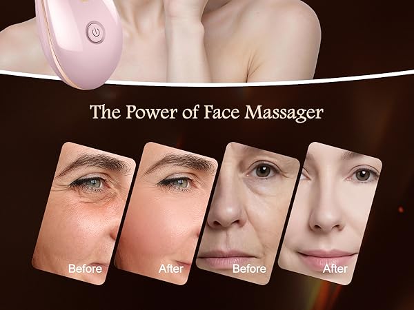 7 Color Face and Neck Massager for Skin Care
