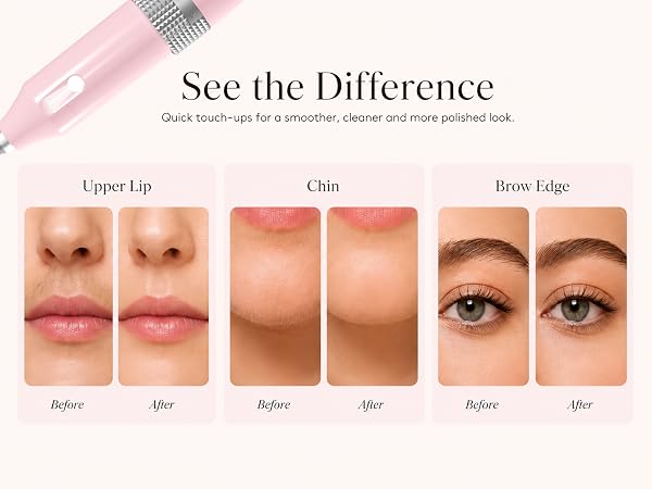 Facial Hair Removal For Women