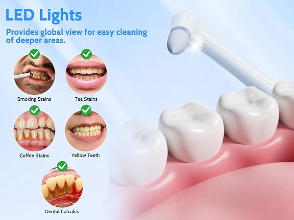Plaque Remover for Teeth