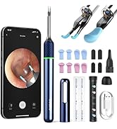 Bebird Note 5 Ear Camera Wax Removal, Ear Wax Removal Tool Camera Ear Tweezers with Camera, 10 Me...