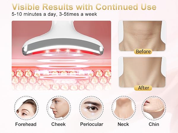 7 Color Portable Facial Massager