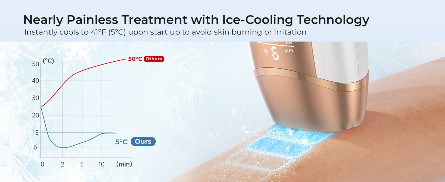 laser hair removal for women