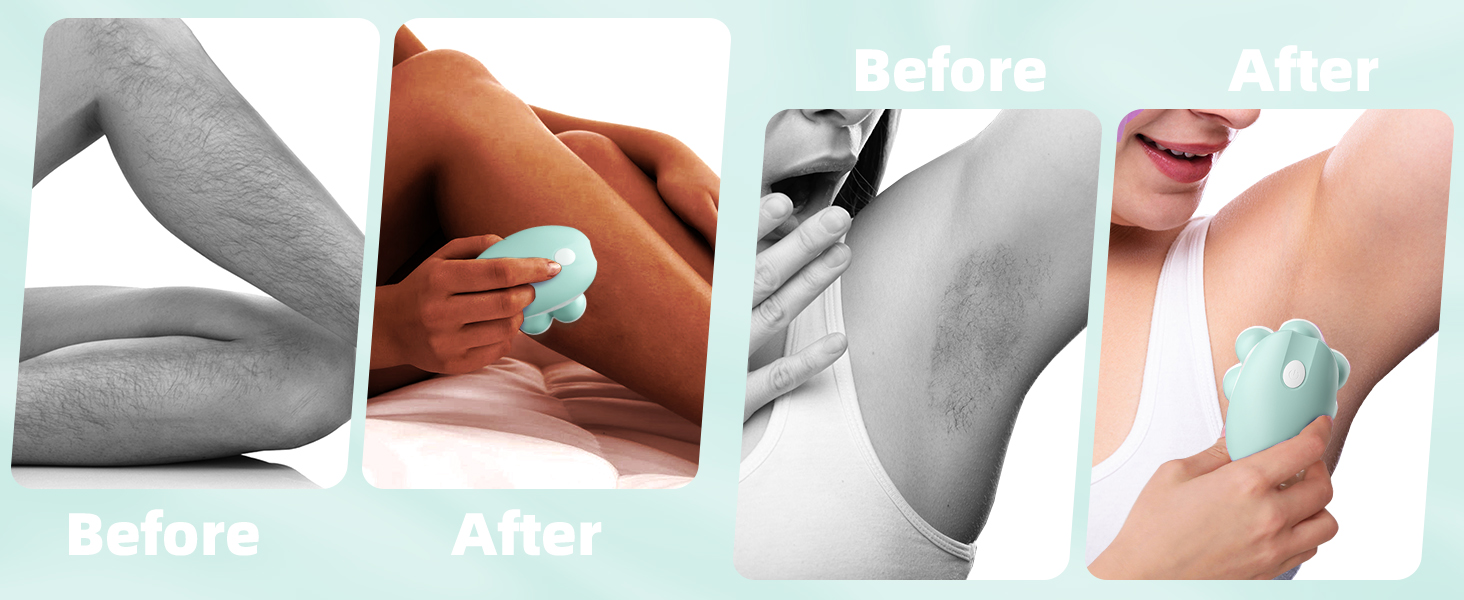 leg shaver for women