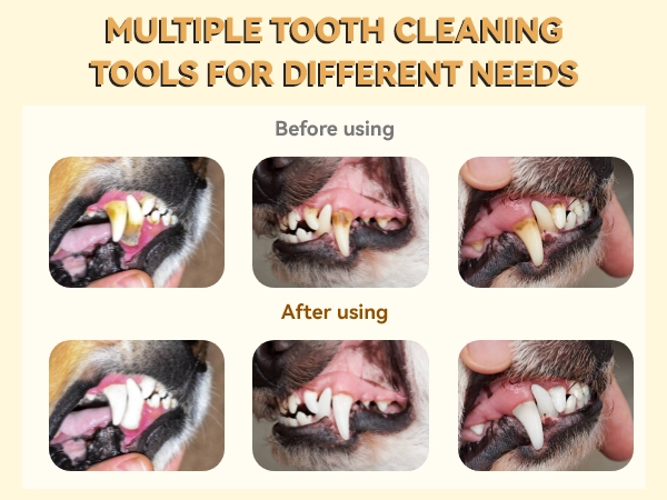 plaque remover for teeth