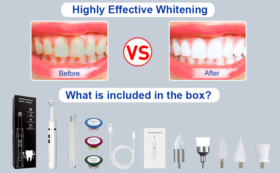Tooth polisher
