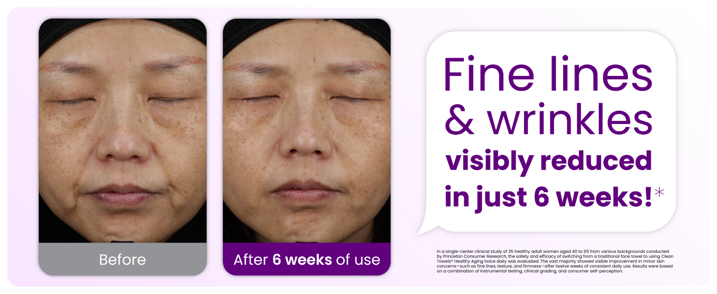 Fine lines and wrinkles visibly reduced in just 6 weeks