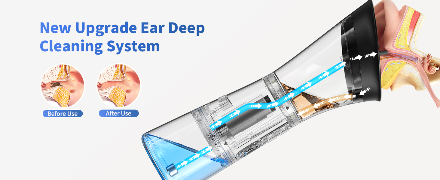 ear cleaning tool