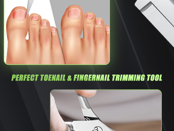 ingrown toenail clippers