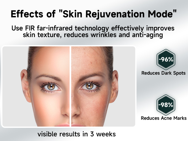 ipl laser hair removal