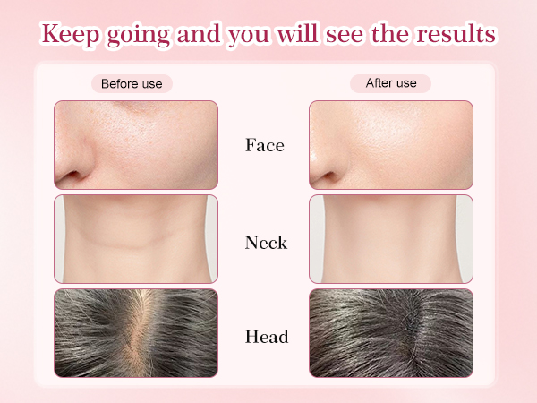 Multi-Functional-Red-Light-Therapy-for-Face and Neck-Eye-Head Massager