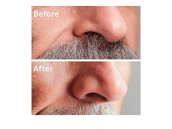 best nose and ear hair trimmer