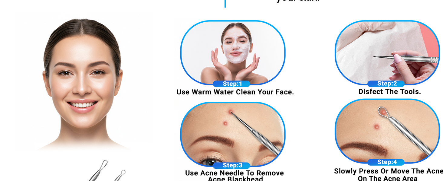 stainless steel pimple extractor