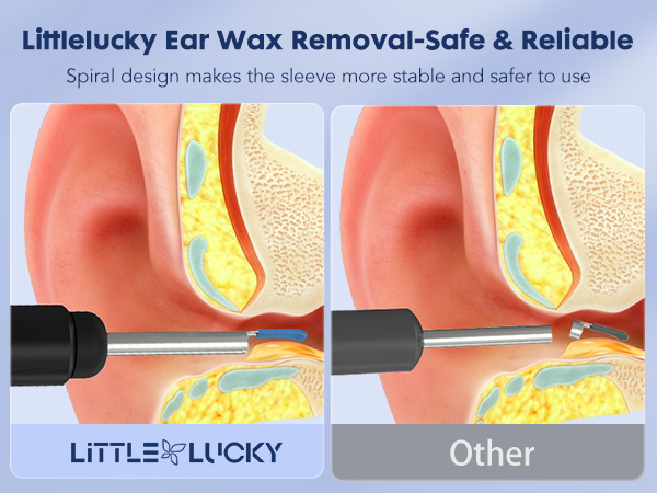 ear wax removal tool camera