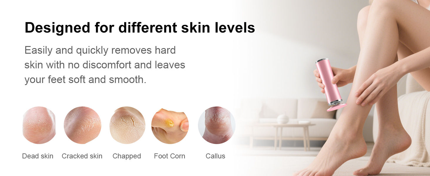 electric foot callus remover