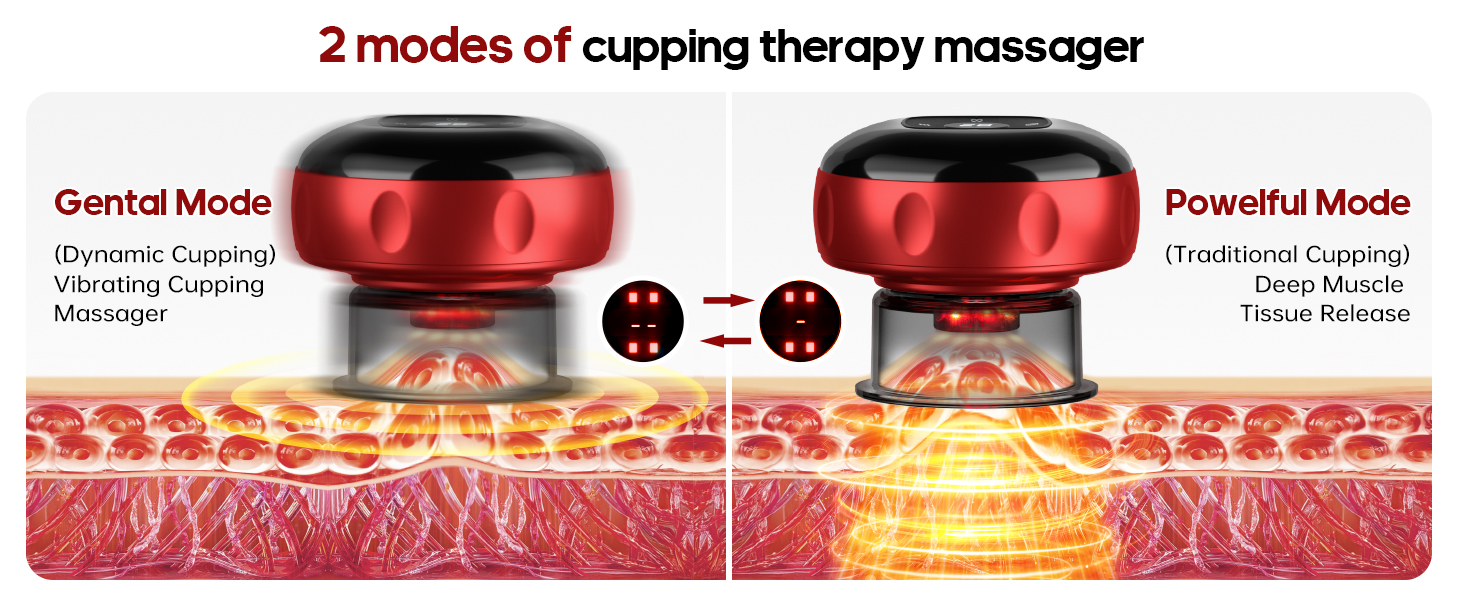 cupping