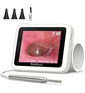ScopeAround Otoscope Ear Camera, 3.9mm Otoscope with Light 720PHD Ear Scope,Digital Otoscope with...