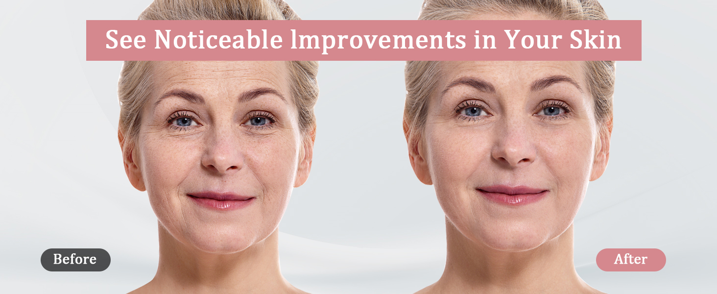 red light face massager