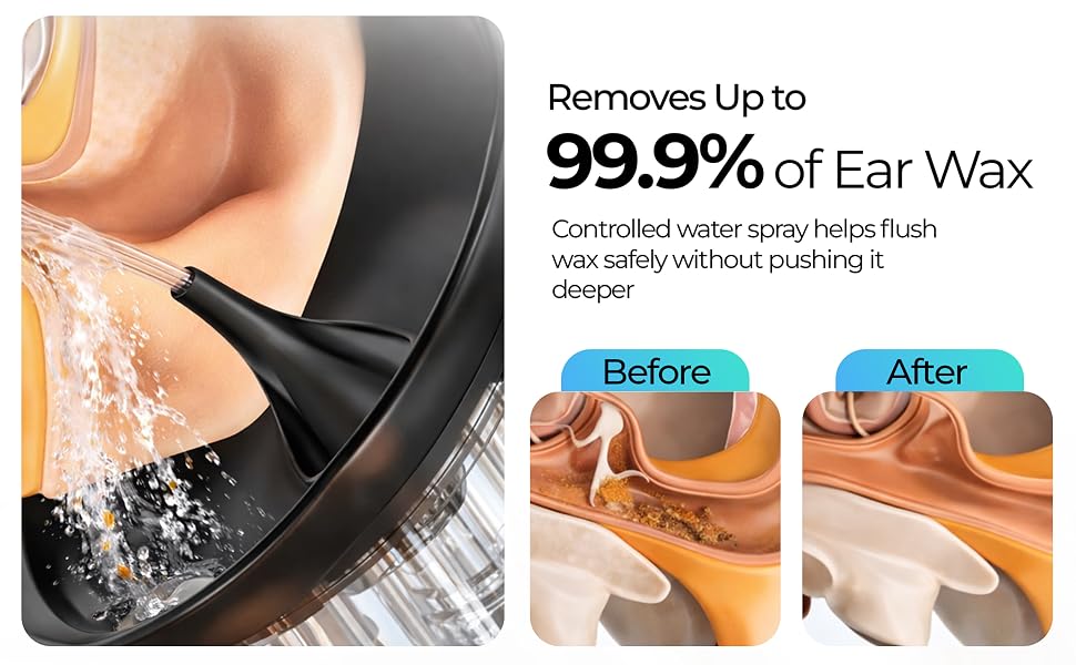 Earwax Removal Tools