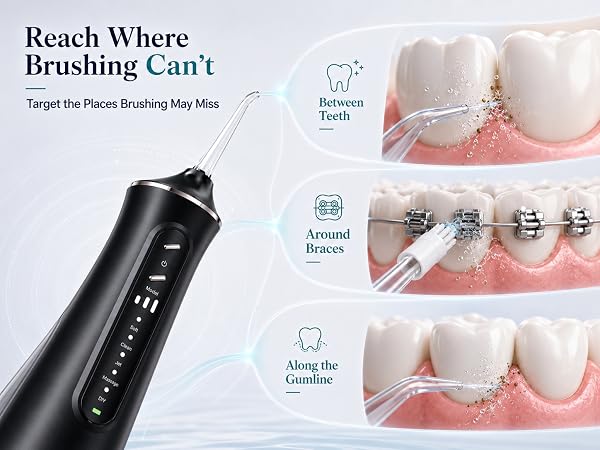 cordless water flosser