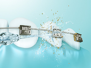 Targeted Cleaning