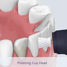 Tooth Polisher