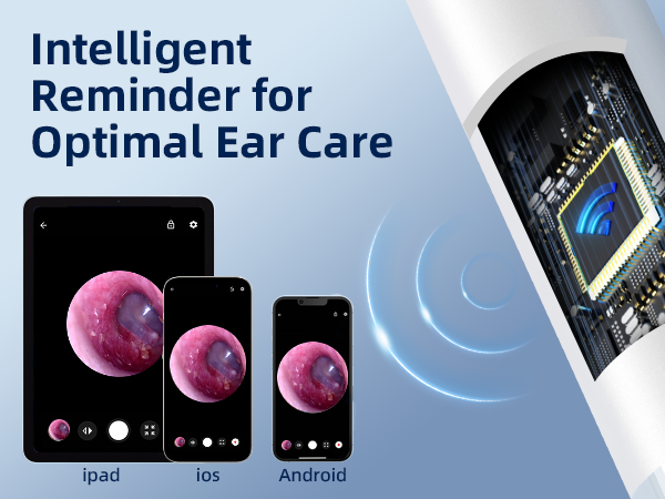 otoscope ear camera