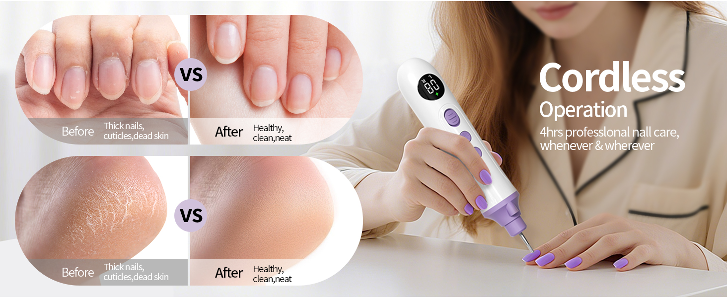 Electric Nail File