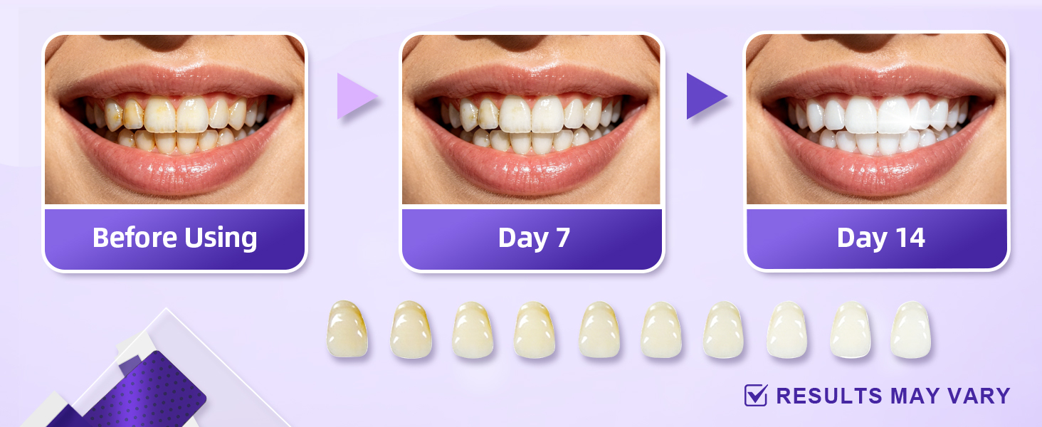 Teeth Whitening Strips