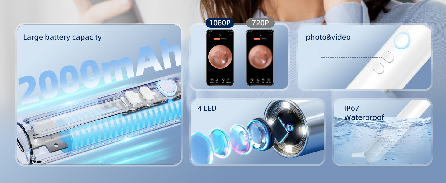otoscope ear camera