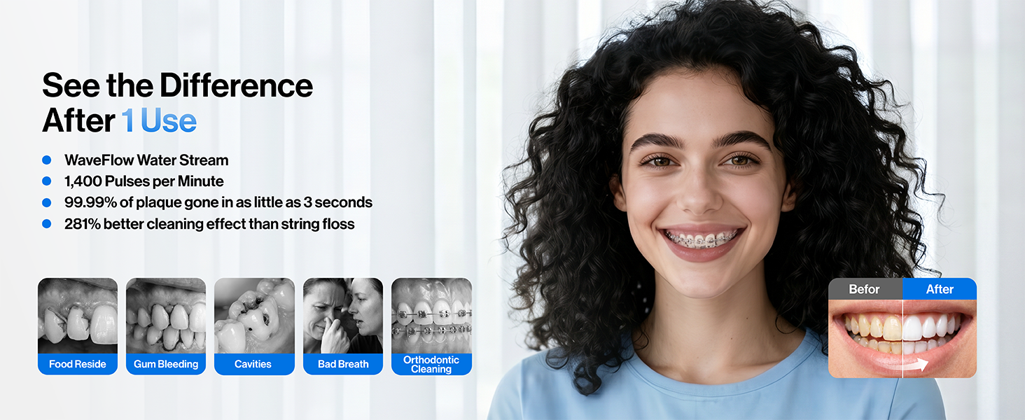 usmile water flosser