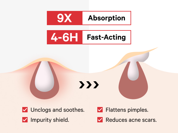 pimple patches