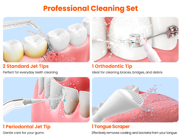 5 Multipurpose Jet Tips