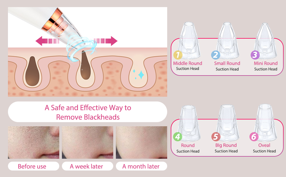 Blackhead remover pore vacuum