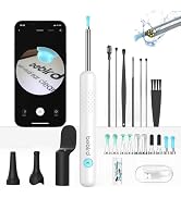 Wireless Otoscope, Ear Camera with 1080P Otoscope &amp; Lights,Ear Wax Removal Tool,Bebird R1 Ear Cle...