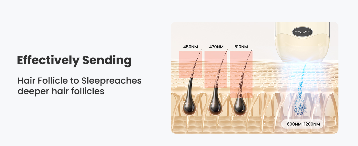 laser hair removal for women