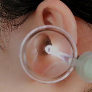 toddler ear wax removal