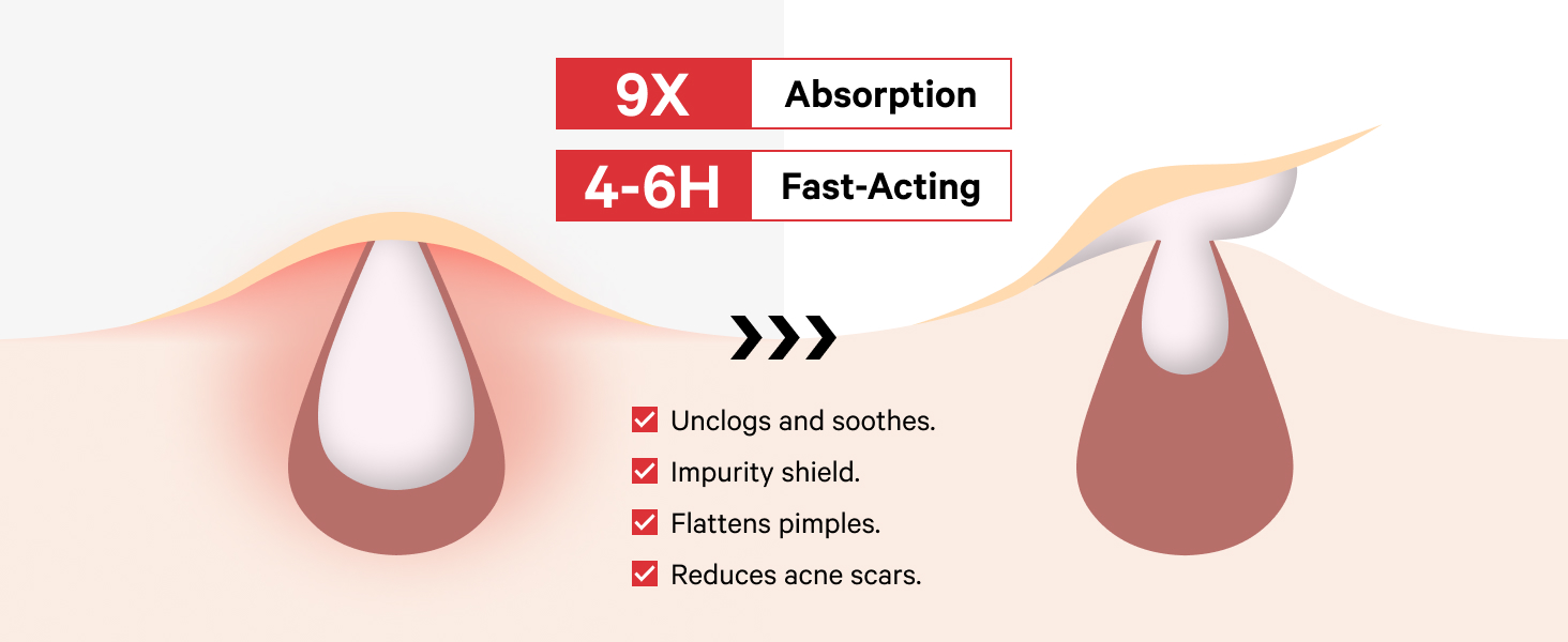 Best pimple patches reduce acne scars and fsa eligible items only list fast acting spot treatment