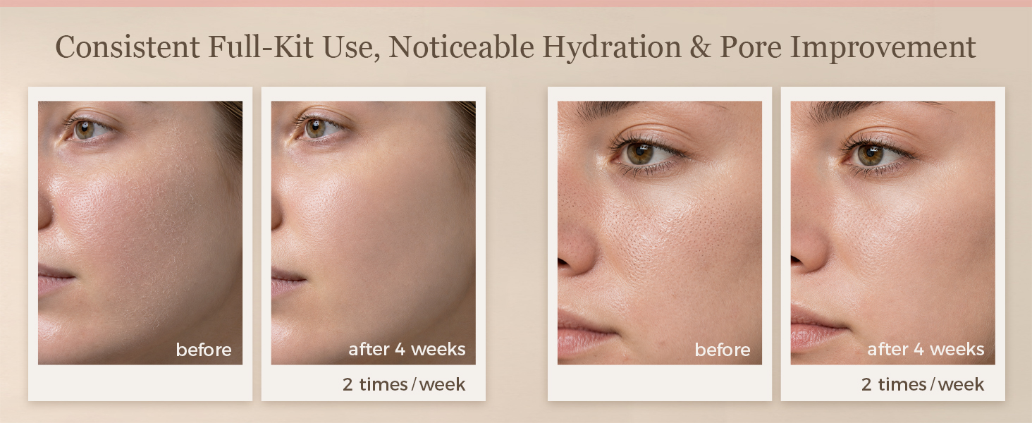 facial steamer