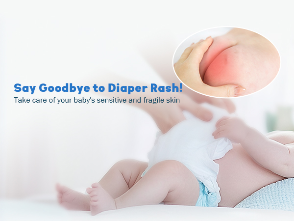 Say Goodbye to Diaper Rash!