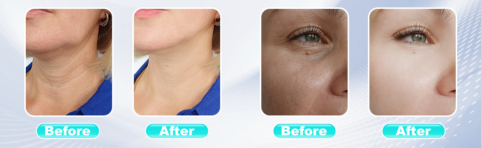 Red Light Therapy Wand