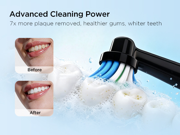 electric toothbrush