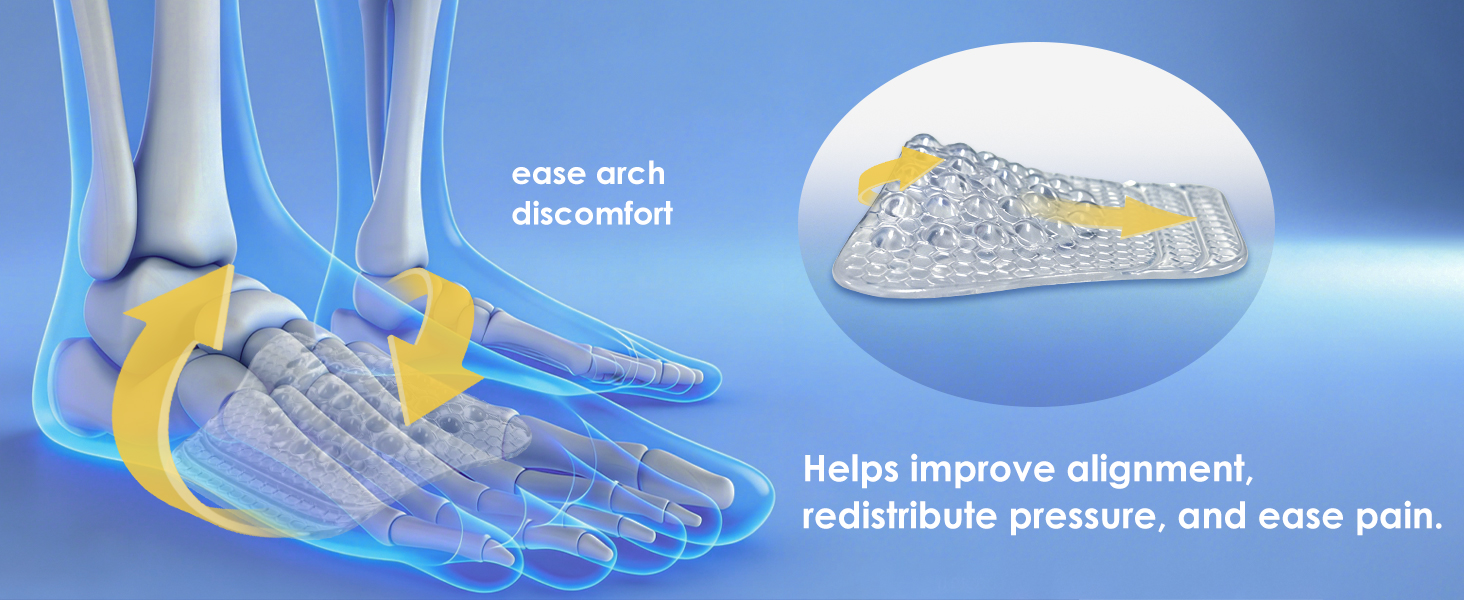 ease arch discomfort help improve alighment redistribure pressure ease pain