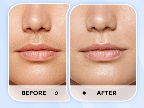 Electric Hair Removal Device for Face Lips Peach Fuzz with Light