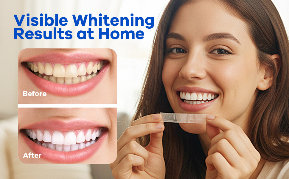 Teeth Whitening Strips 03
