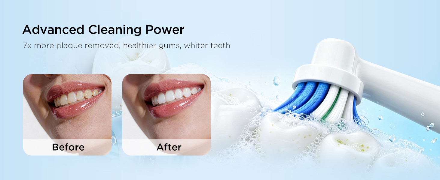 electric toothbrushes