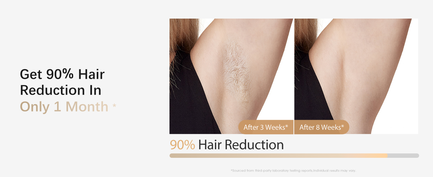 best laser hair removal device